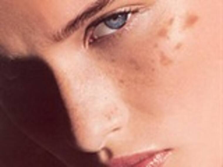 'Saludhablemente W' del sábado 02 de julio. Cáncer de piel