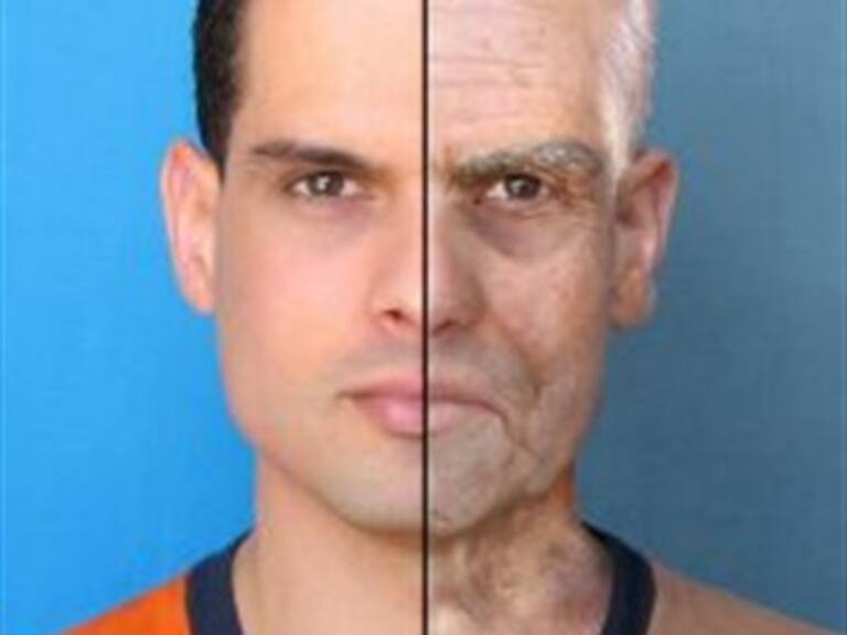 Descubre cómo las hormonas afectan nuestra piel