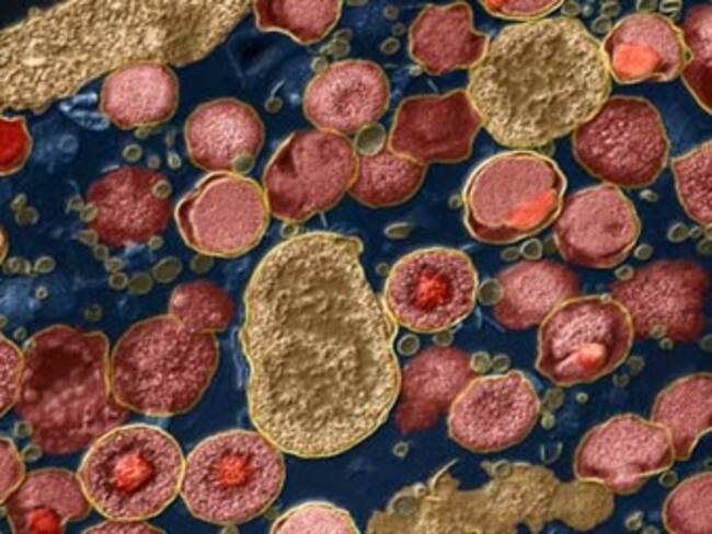 'Super bacteria' KPC se expande de capital brasileña hacia estados