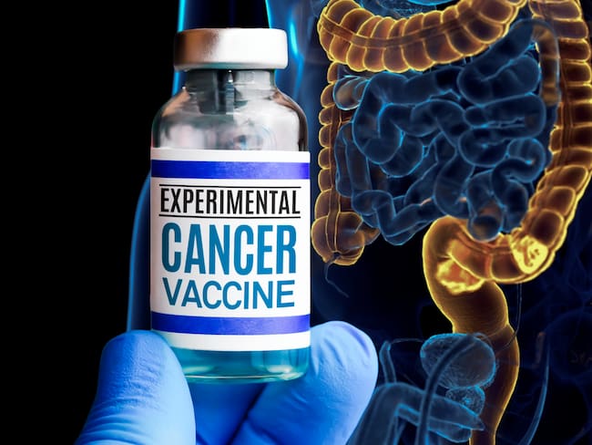 ¿La vacuna rusa contra el cáncer será gratis? Estos pacientes podrán recibirla sin costo alguno