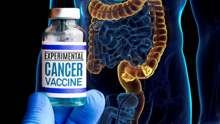 ¿La vacuna rusa contra el cáncer será gratis? Estos pacientes podrán recibirla sin costo alguno