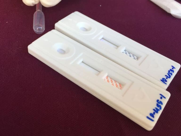 CoeSida instala módulos de pruebas rápidas de VIH