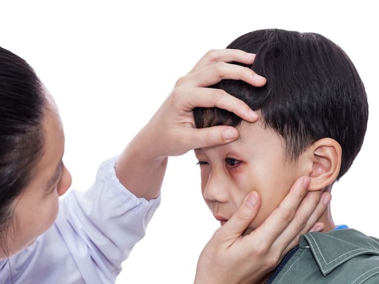 Los 5 accidentes en casa más comunes en niños