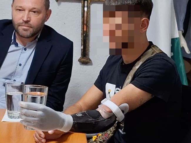 Diáspora Ucraniana y UNAM brindarán prótesis por conflicto Rusia-Ucrania