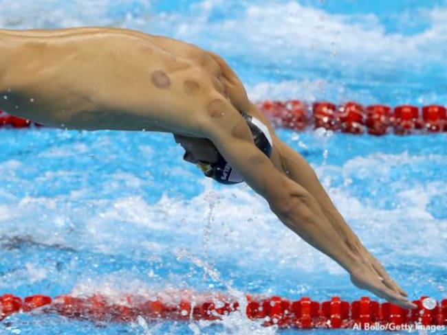 ¿Por qué los atletas tienen unos círculos rojos en su cuerpo?
