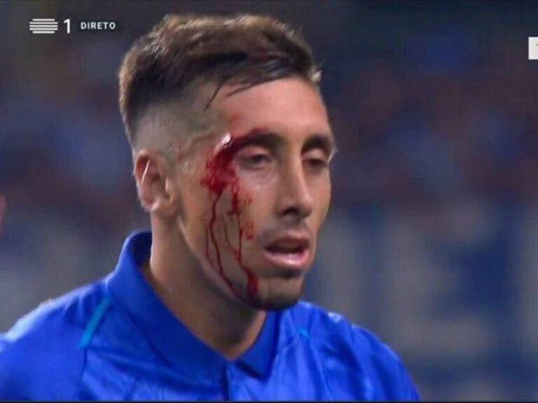 Estrenan rostro de Héctor Herrera