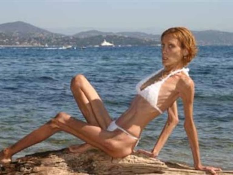 Muere la modelo Isabelle Caro, tras ardua lucha contra la anorexia