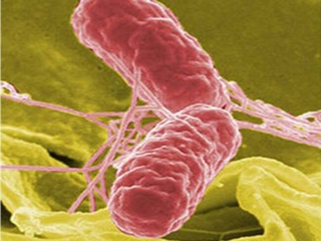 Muere un hombre por salmonelosis en EU