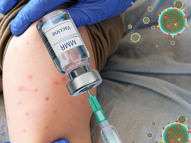 Vacuna contra el Sarampión en CDMX: ¿En dónde están vacunando HOY?; Módulos y horarios