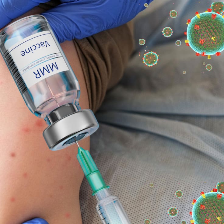 Vacuna contra el Sarampión en CDMX: ¿En dónde están vacunando HOY?; Módulos y horarios