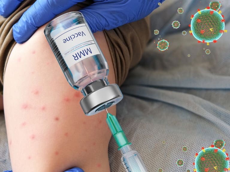 Vacuna contra el Sarampión en CDMX