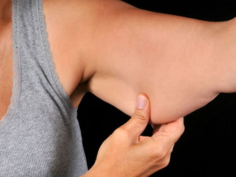 Los brazos son un estigma de juventud especialmente cuando los músculos están delineados