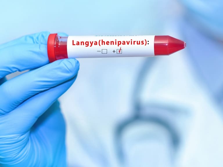 ¿Qué es el Henipavirus Langya?