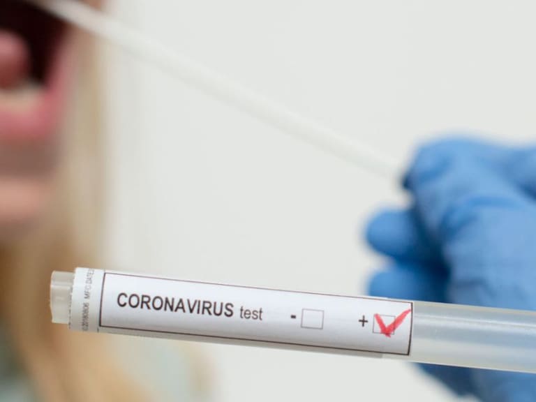 Médicos lamentan que las personas no crean en el coronavirus