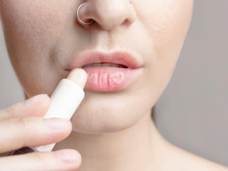 Profeco revela receta y cuidados para labios resecos. Getty Images