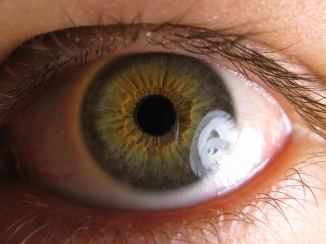 Síntomas que revelan que tienes problemas en la retina