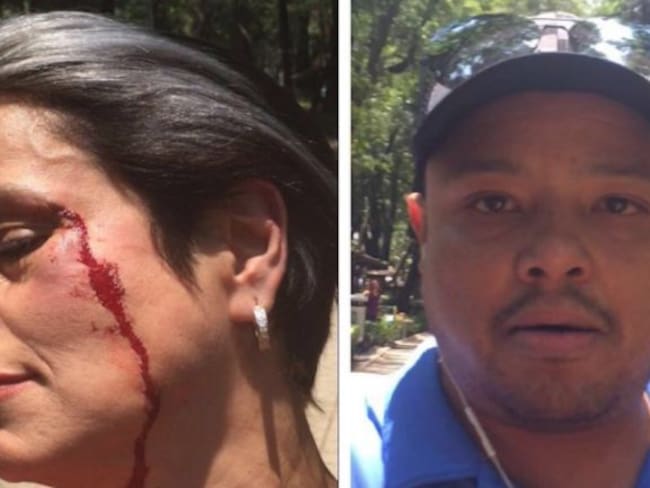 #LordPopó golpea a mujer que le pidió levantar las heces de su perro