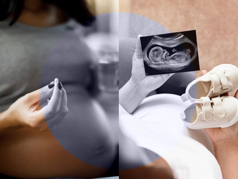 La presunta relación entre el consumo de paracetamol durante el embarazo y condiciones como el autismo y TDAH fue estudiada por científicos británicos.