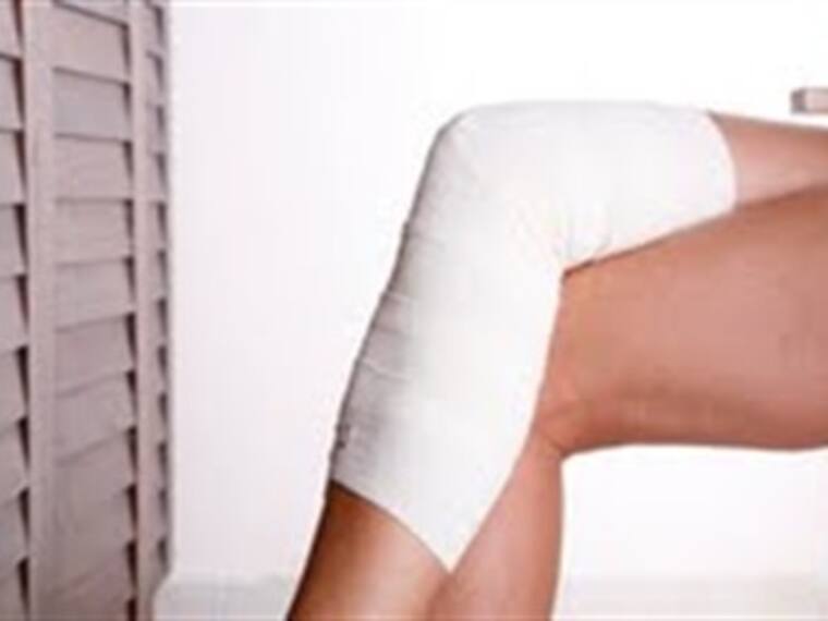 Todo sobre las Várices