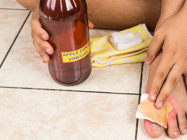 Vinagre de manzana para quitar verrugas: ¿realmente funciona? Esto dicen dermatólogos