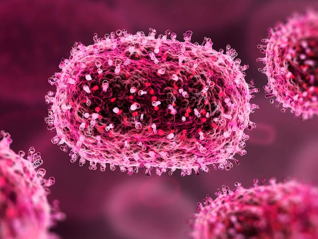 Cancún registra primer muerte por viruela del mono en Quintana Roo; estos son los síntomas