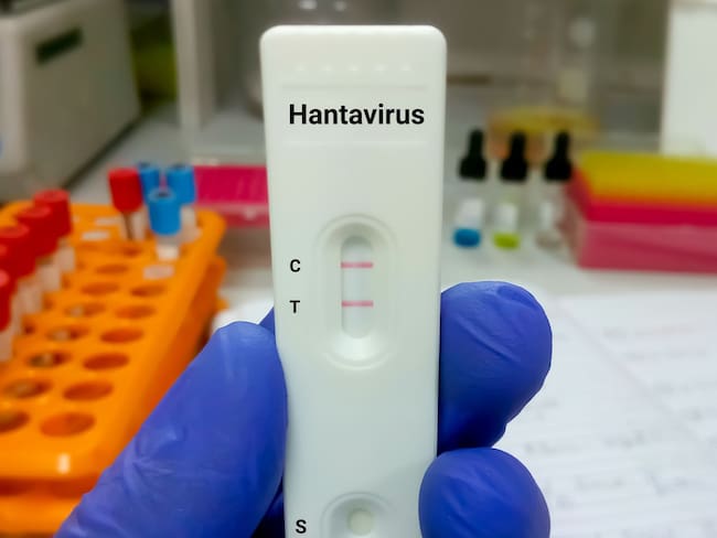 Hantavirus nuevos contagios: Aumentan casos ligados al crucero MV Hondius y crece vigilancia internacional
