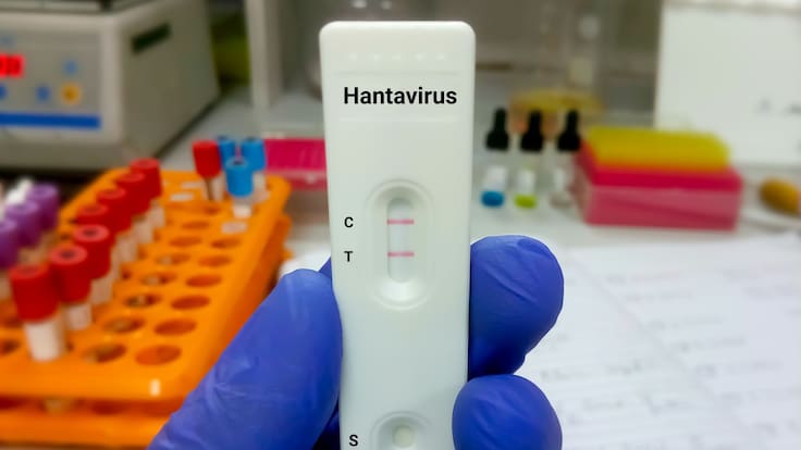 Hantavirus nuevos contagios: Aumentan casos ligados al crucero MV Hondius y crece vigilancia internacional