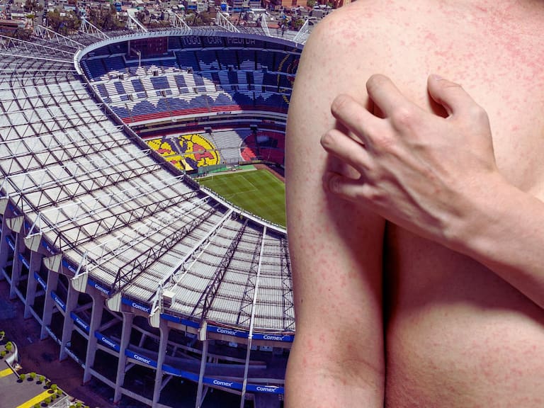 Autoridades de Salud explican si existe riesgo real para el Mundial 2026 en México. Getty Images/Canva