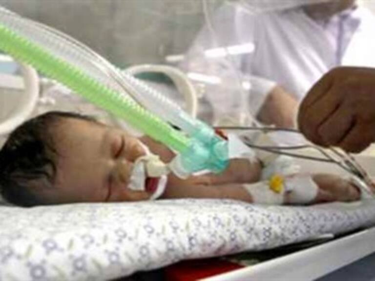 Fallece la "bebé milagro" de Gaza