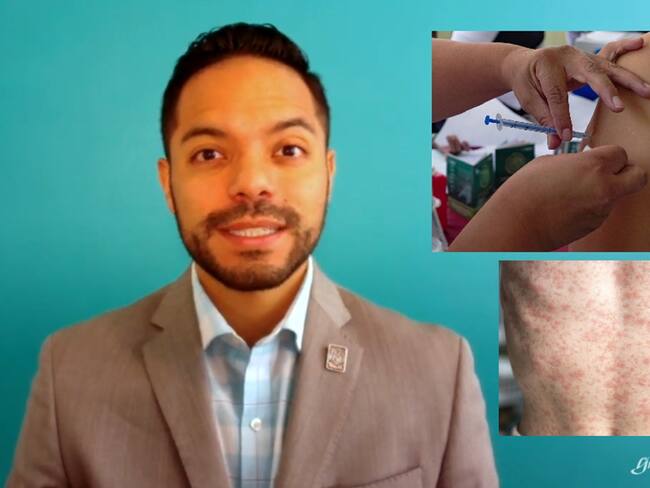 México encabeza el contagio de sarampión en las Américas, con 3,700 casos confirmados y 14 muertes: Baruch Díaz