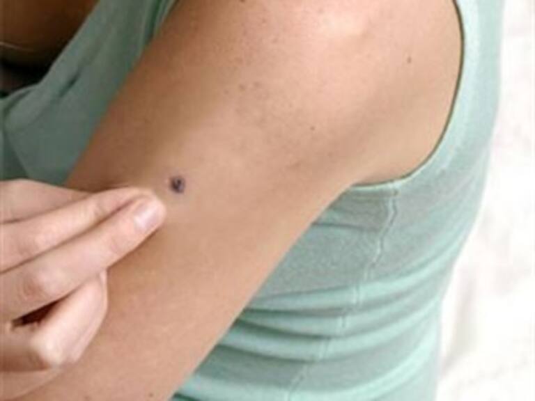 Evita el cáncer de piel