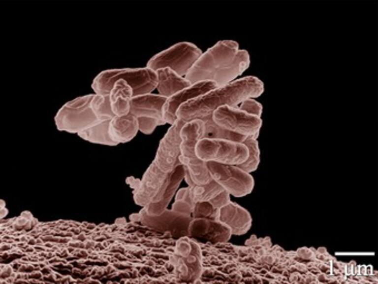 Diccionario: Escherichia coli (E.coli)