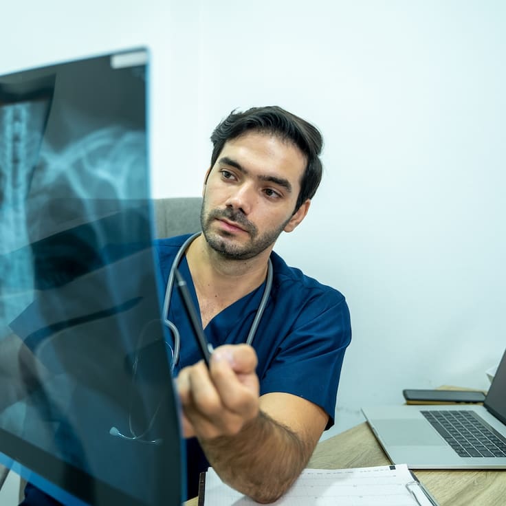 Tuberculosis: Yucatán registra incremento de casos respecto al año pasado