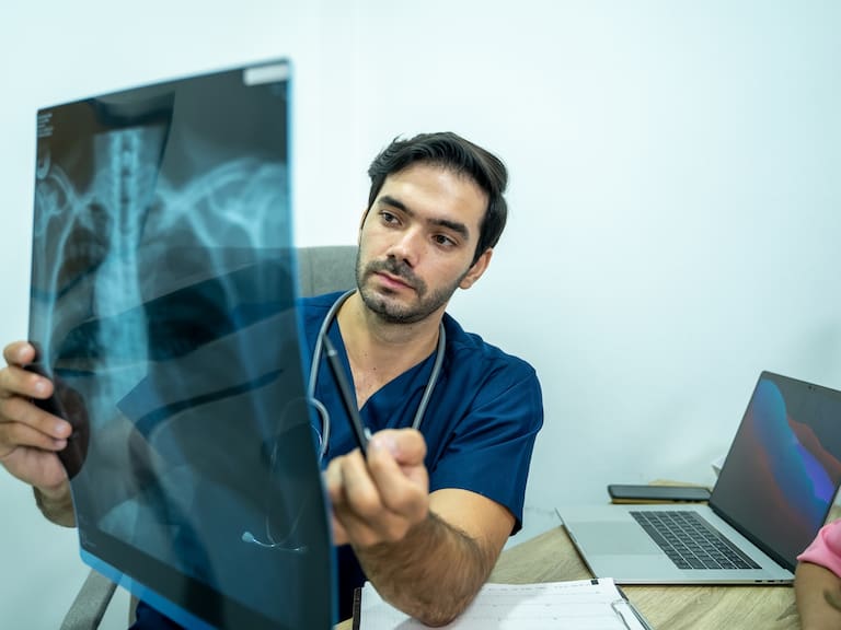 Yucatán registra 57 casos de tuberculosis, un incremento del 23% respecto a 2025, cuando se contabilizaron 46 pacientes.