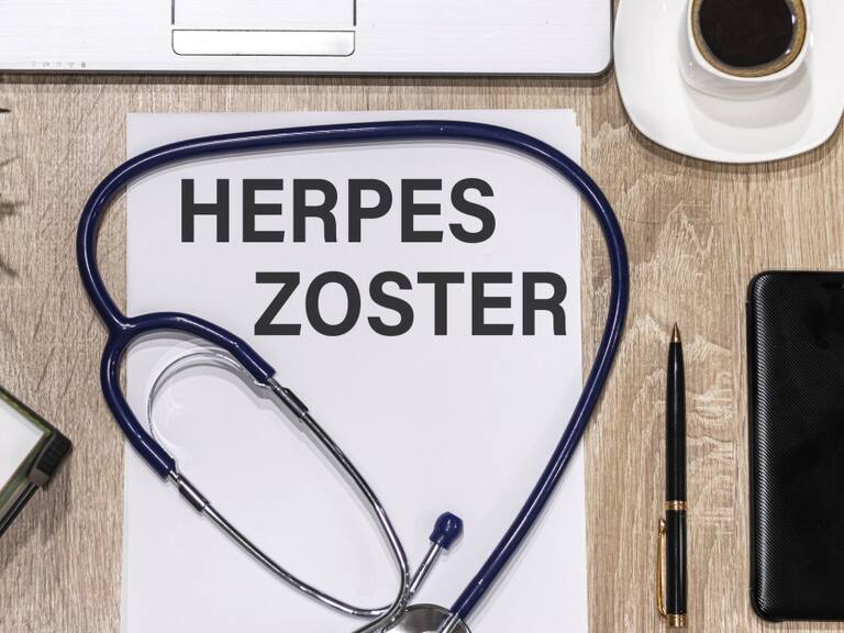 Herpes Zóster: el remake de la varicela