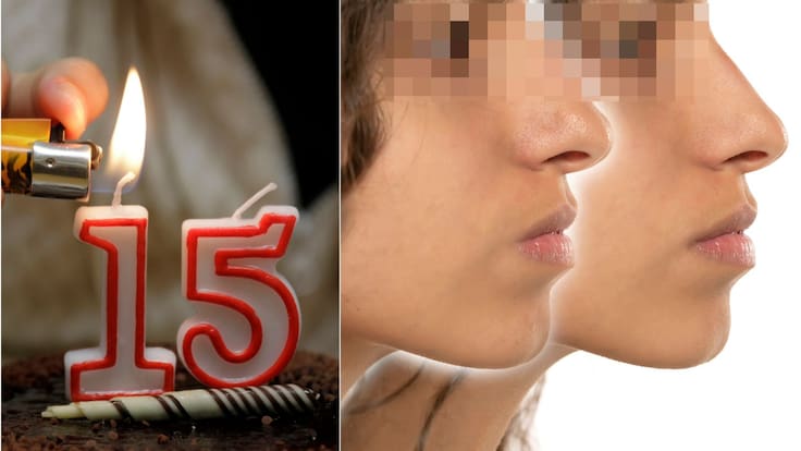 Pidió una rinoplastia como regalo de XV años y terminó con infarto cerebral: el caso de Fernanda