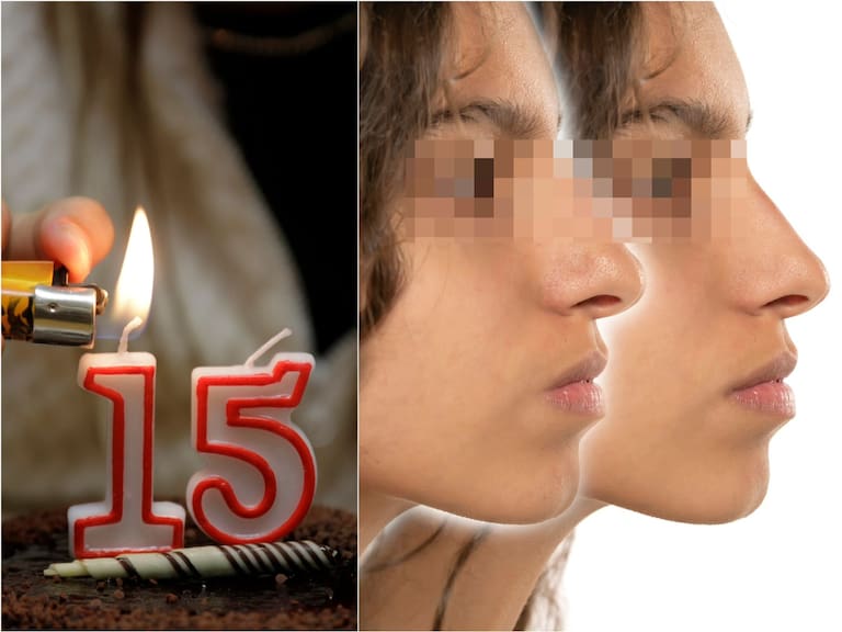 La rinoplastia que pidió como regalo de XV años le provocó un infarto cerebral a Fernanda, quien además presenta parálisis y pérdida de la memoria.