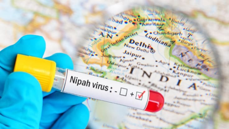 Virus Nipah en la India: Casi 200 pruebas negativas desmienten cifras especulativas, informan autoridades