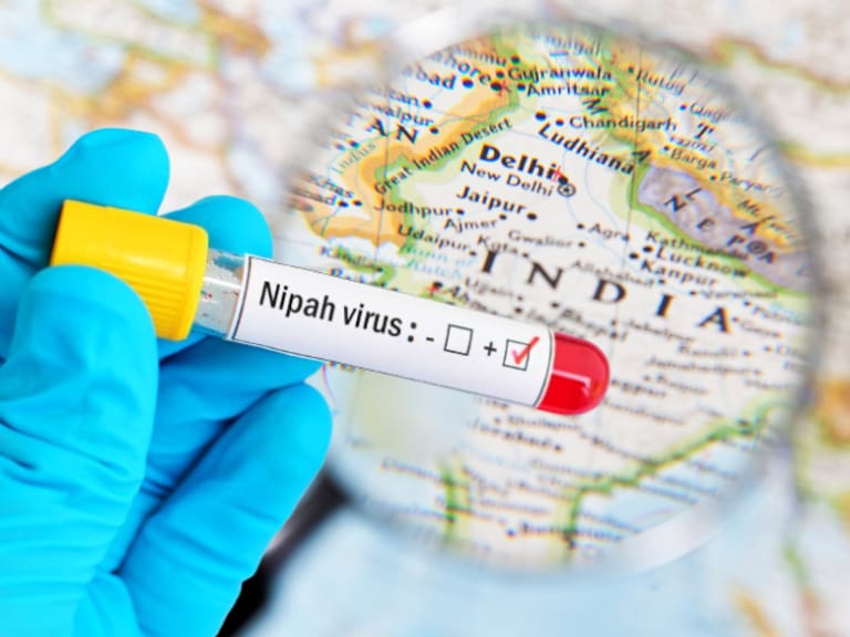 El virus Nipah es un patógeno zoonótico que las autoridades de la India mantienen bajo estrecha vigilancia tras confirmarse dos casos en Bengala Occidental.