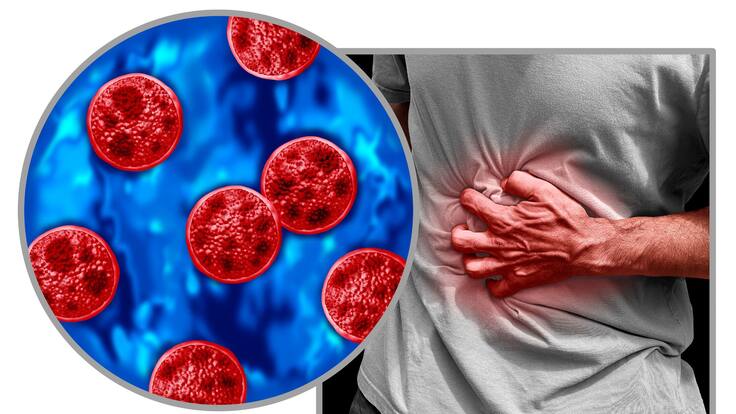 Qué es la Cyclospora: síntomas, cómo se transmite y por qué no se define su origen