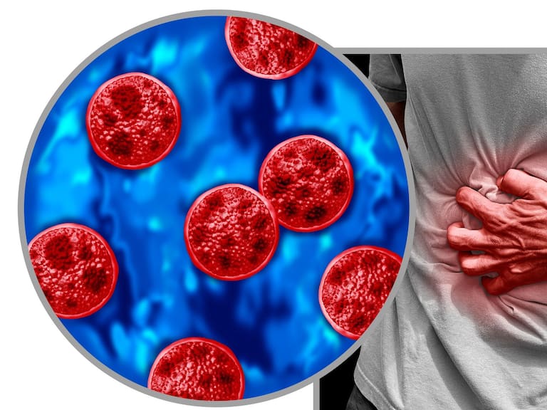 FDA y CDC investigan el origen del brote en 2026. Getty Images
