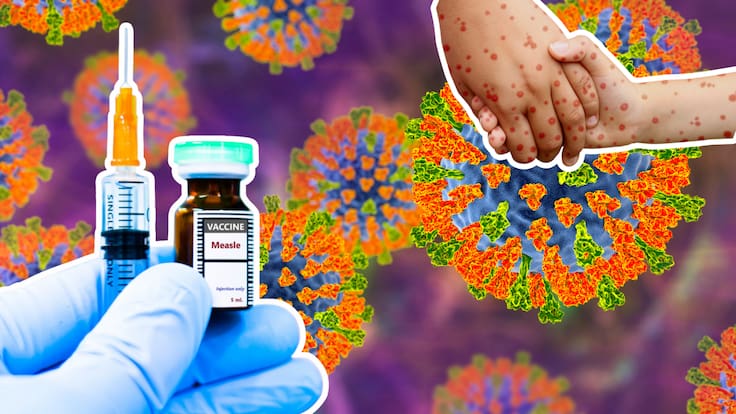 Vacuna contra el sarampión: efectos, síntomas y qué es normal sentir