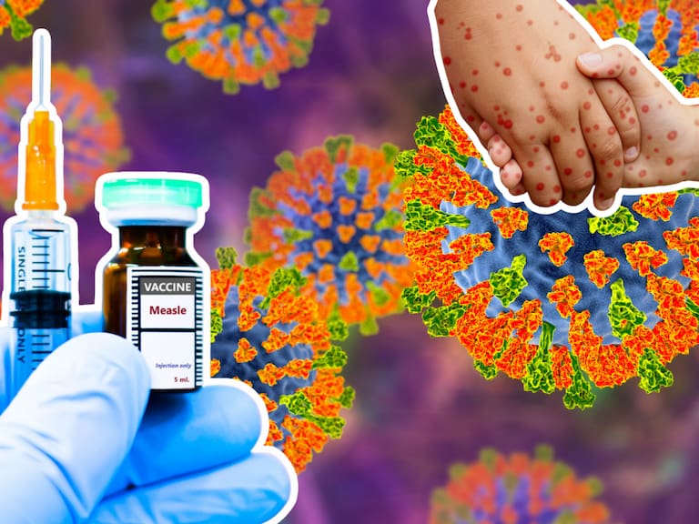 Vacuna contra el sarampión efectos