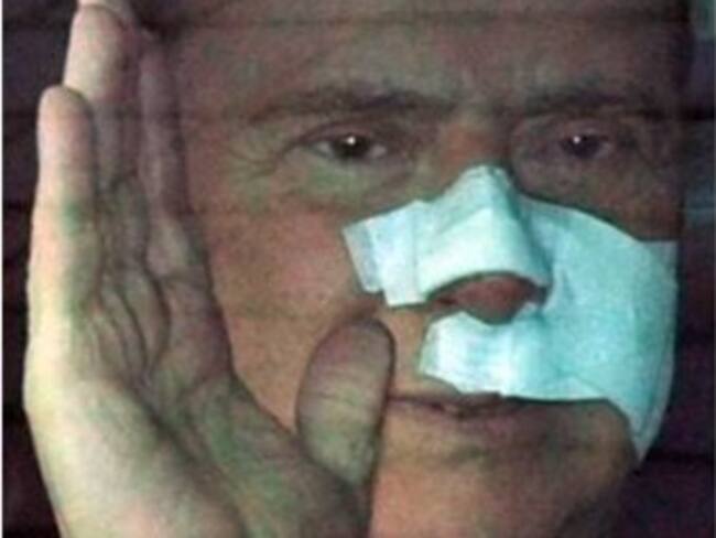 Agresiones a Berlusconi y Papa desatan temor a 'emulación'