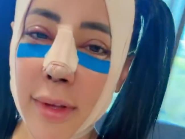 Sandra Cuevas reaparece tras nueva cirugía plástica: así luce la exalcaldesa