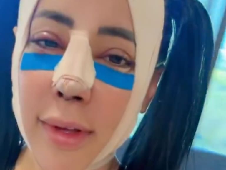 Sandra Cuevas cambia de imagen otra vez: así quedó tras su nueva cirugía estética. IG