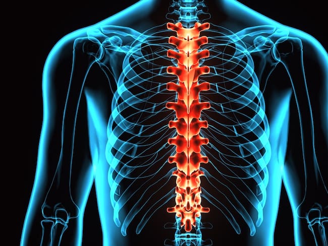 Pectus excavatum y malformaciones de torax