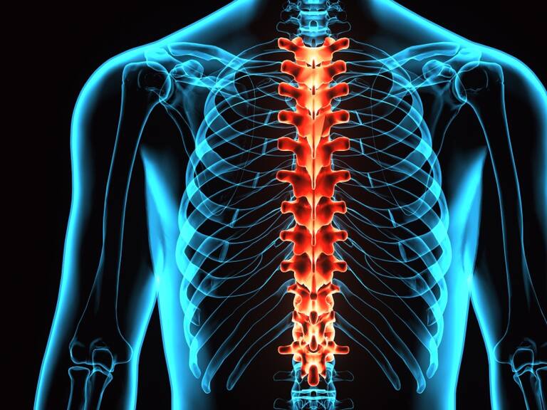 Pectus excavatum y malformaciones de torax
