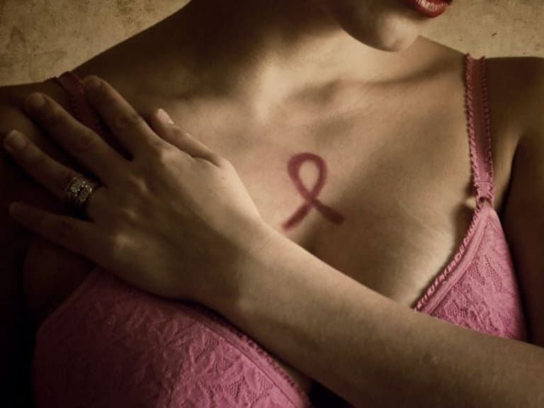 Sobrevivir al cáncer de mama es posible ¡PREVENCIÓN!