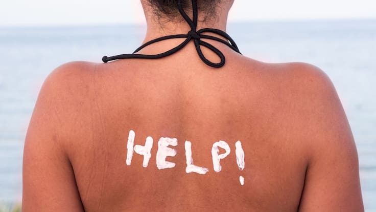 Cuidados de la piel por el sol en la playa ¡Sigue tips!